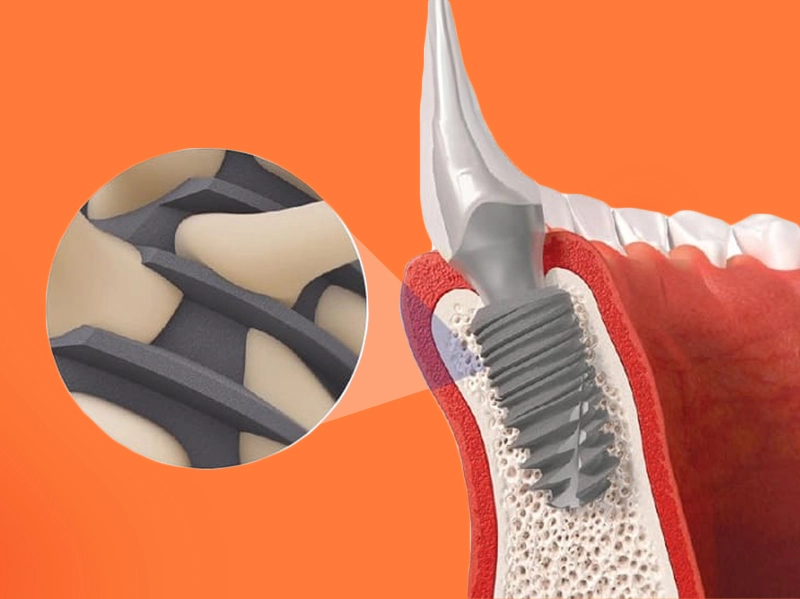 Khả năng tích hợp xương hàm tốt