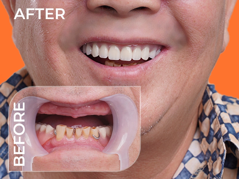 Tính thẩm mỹ cao