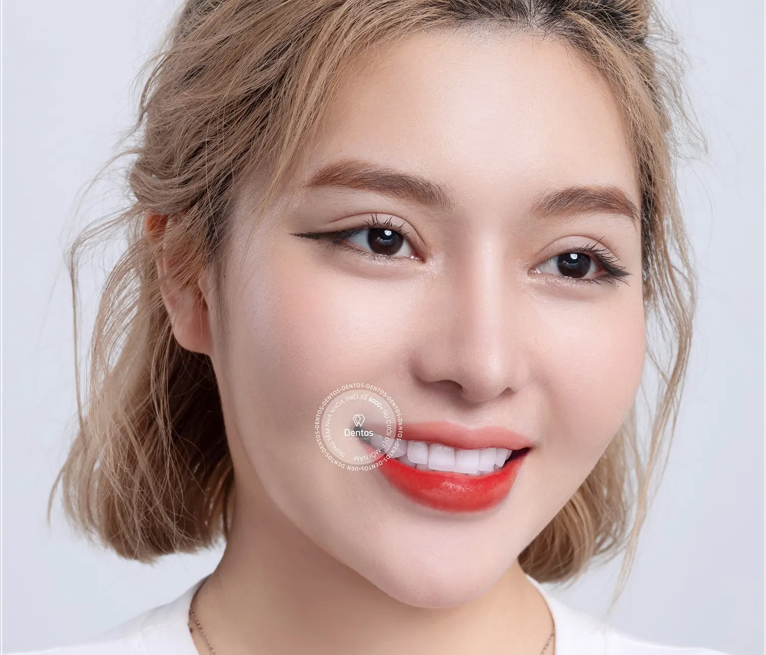 Giá làm răng sứ bao nhiêu? Những lưu ý trước khi bọc sứ