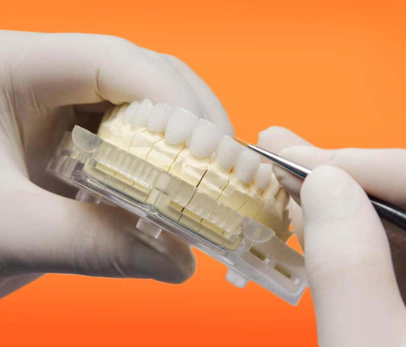 Quy trình làm răng sứ chuẩn gồm những bước nào?