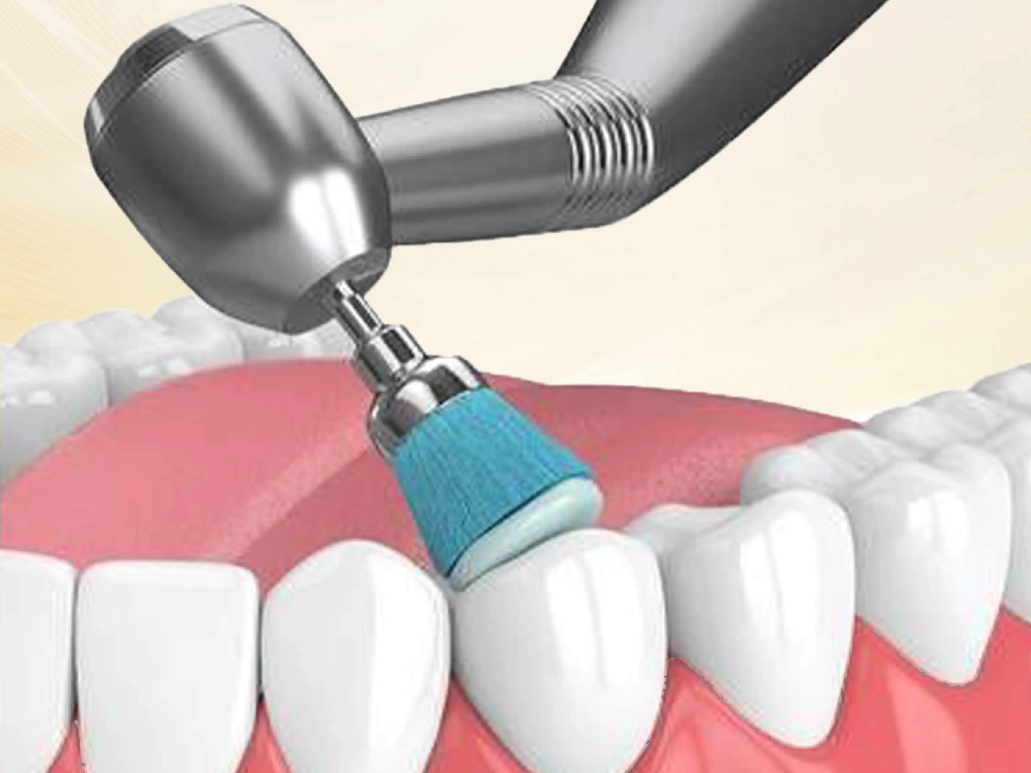 Đánh Bóng Hoàn Thiện