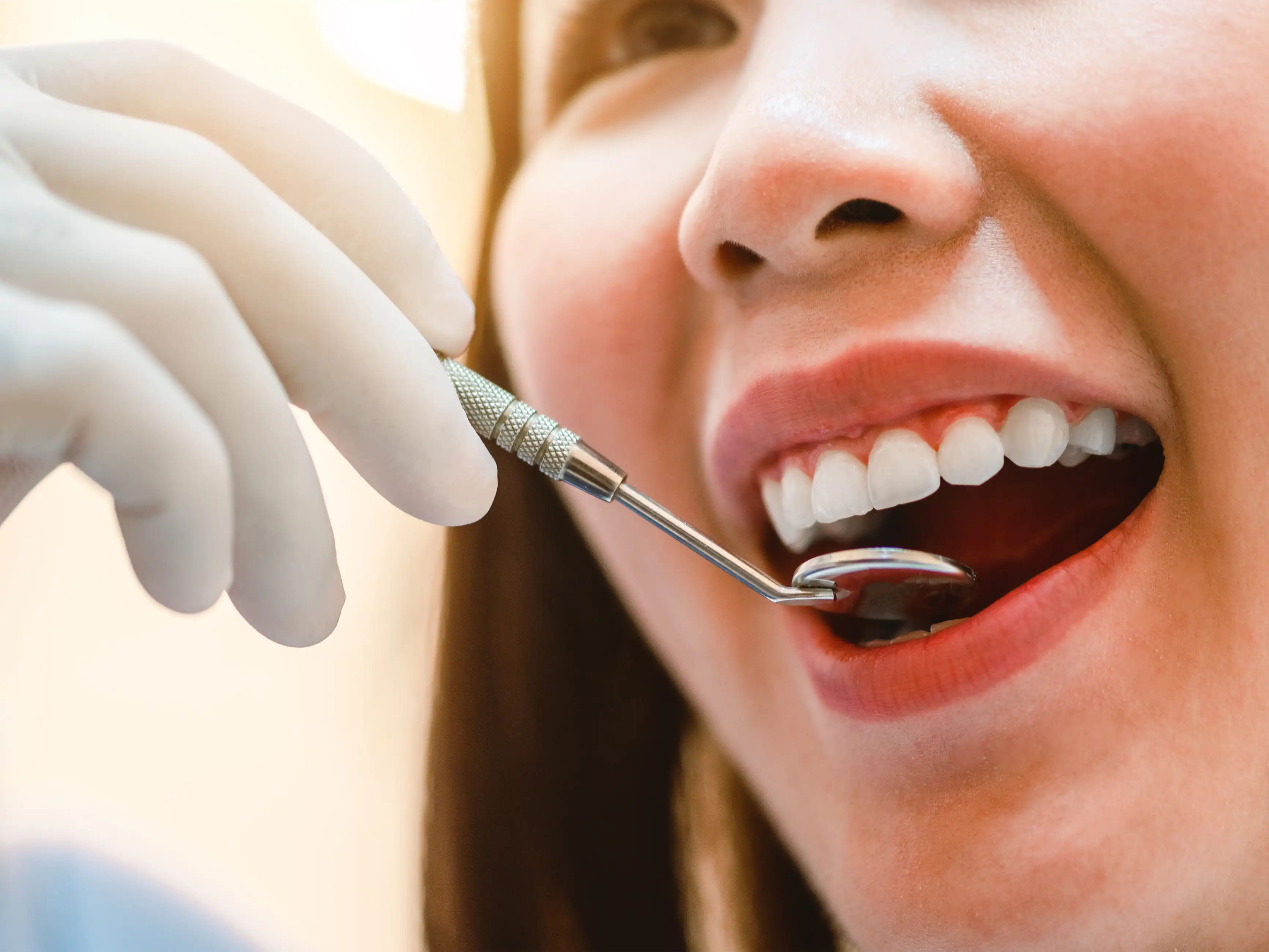 Làm Sao Để Phòng Ngừa Sâu Răng Hiệu Quả?