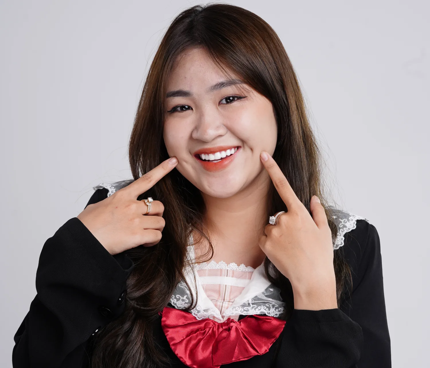 Răng sứ Cercon ht của nước nào? Giá bao nhiêu?