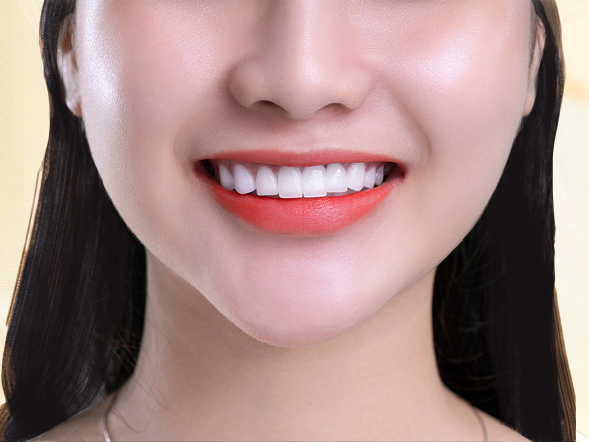 Răng Toàn Sứ Zirconia Đức - Ưu điểm 1