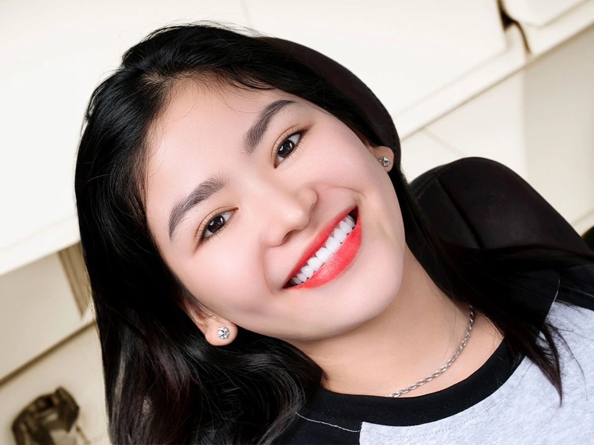 Đừng Chờ Đợi Nụ Cười Hoàn Hảo - Hãy Kiến Tạo Nó Ngay Hôm Nay! (Veneer)