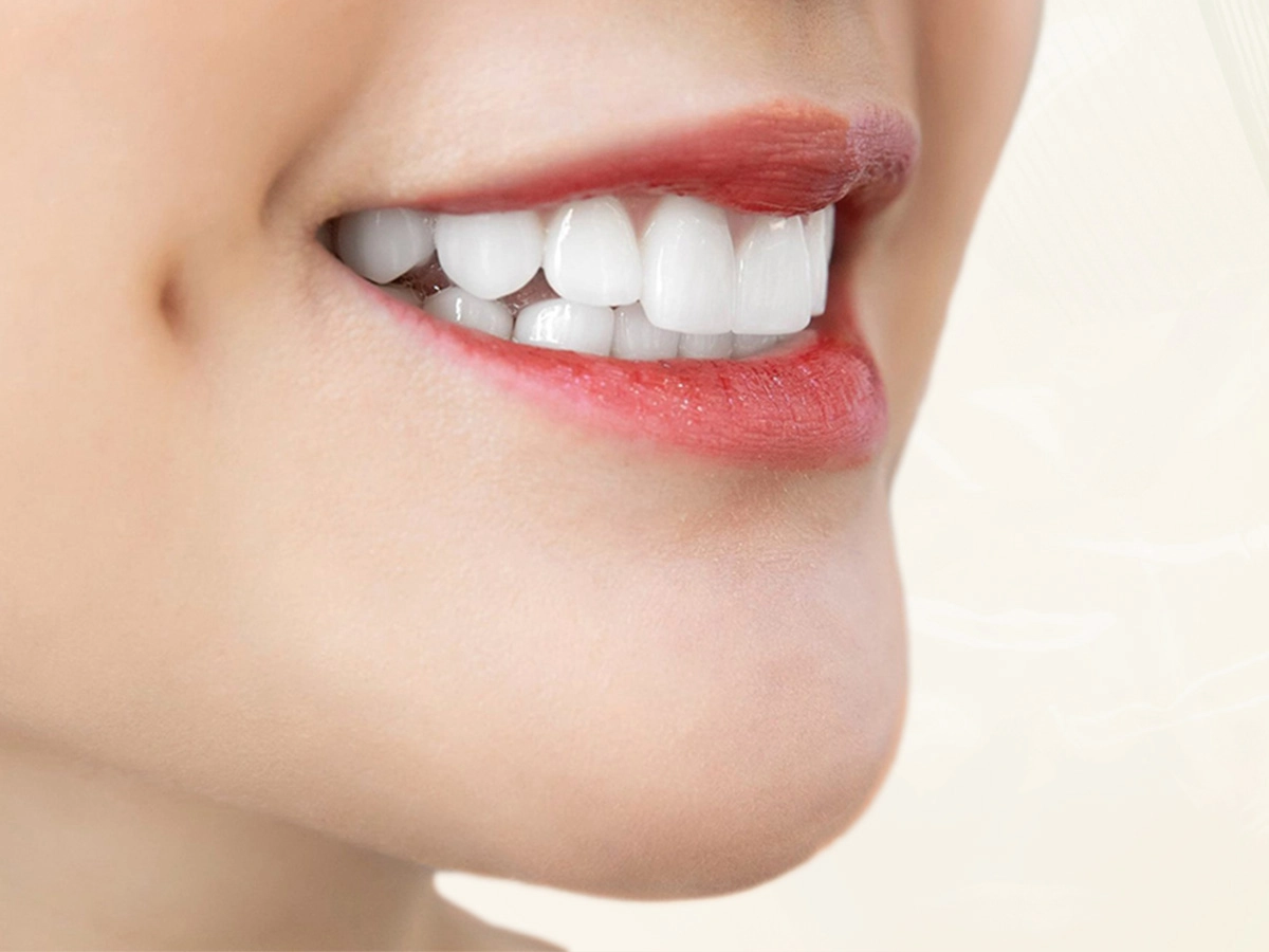 Sự thật về bọc răng sứ