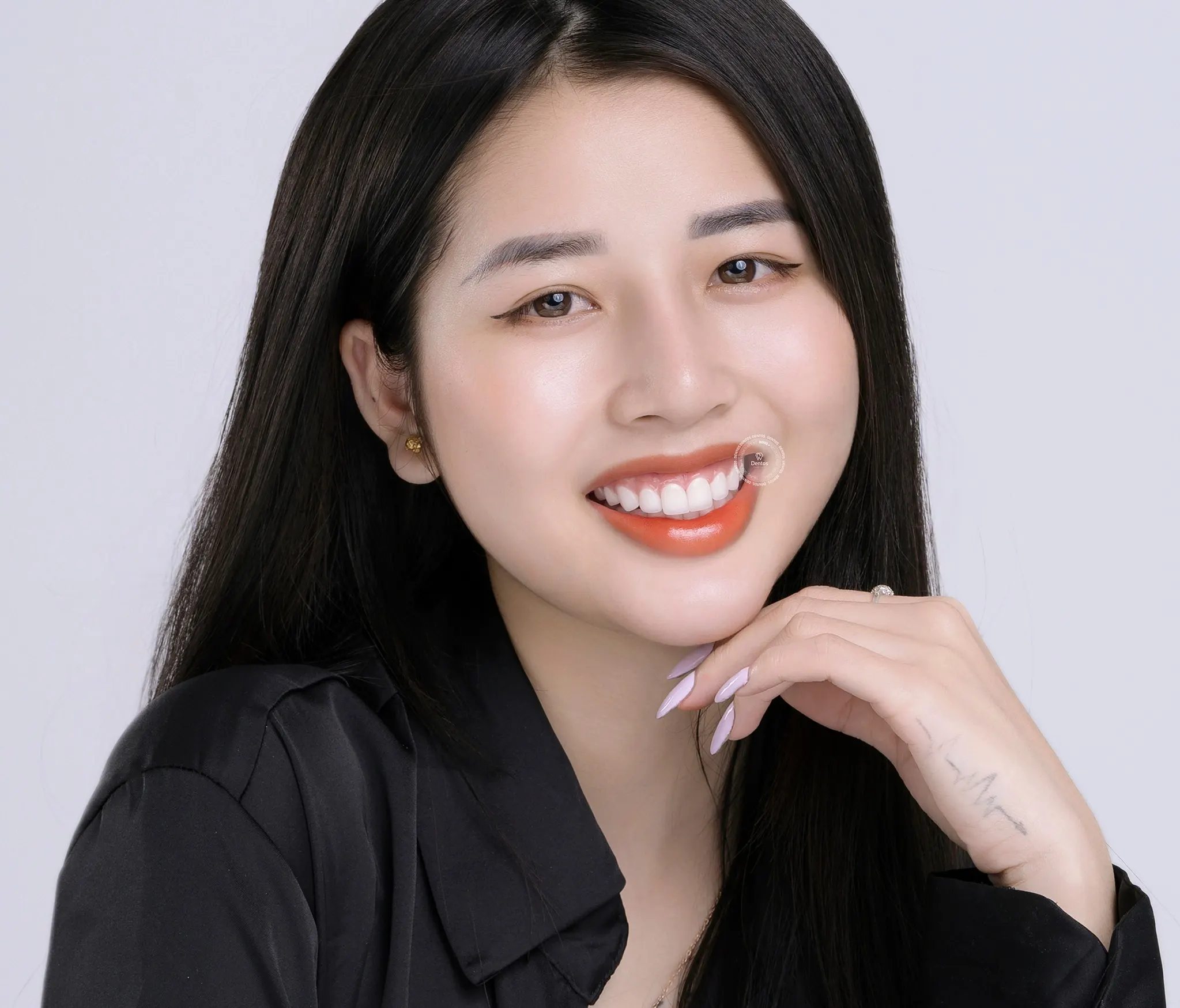 Răng sứ bao nhiêu một cái? Bảng giá & Cách nhận biết Nha khoa uy tín