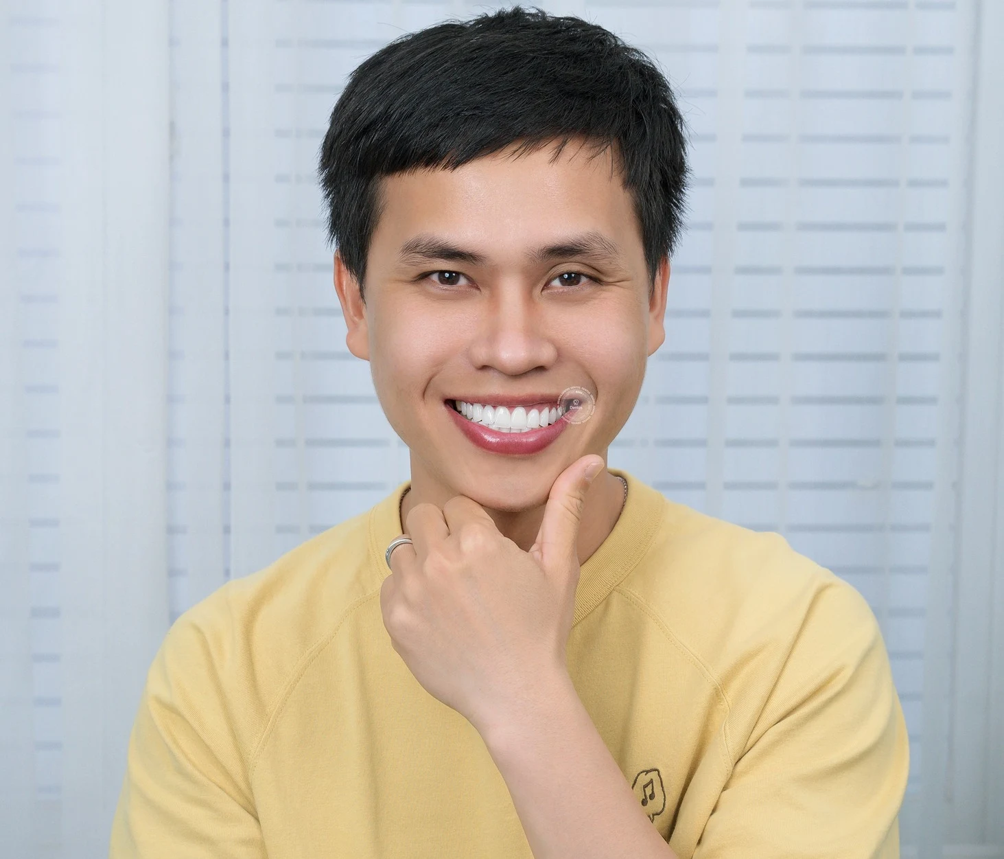 Răng sứ Zirconia có mấy loại? So sánh, ưu điểm & Bảng giá chi tiết