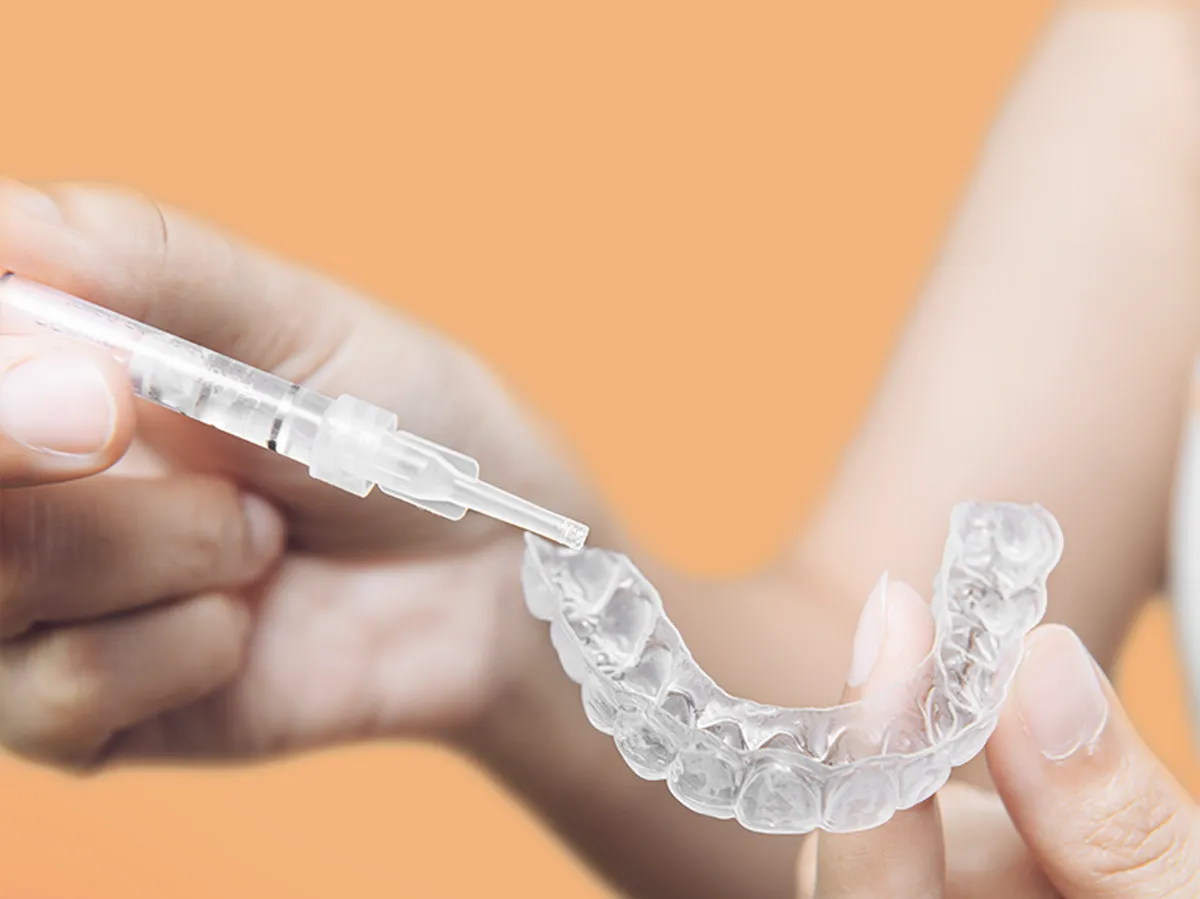 Tẩy Trắng Răng Tại Nhà