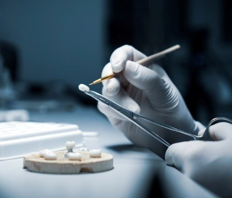 Chi tiết quy trình bọc răng sứ thẩm mỹ chuẩn y khoa