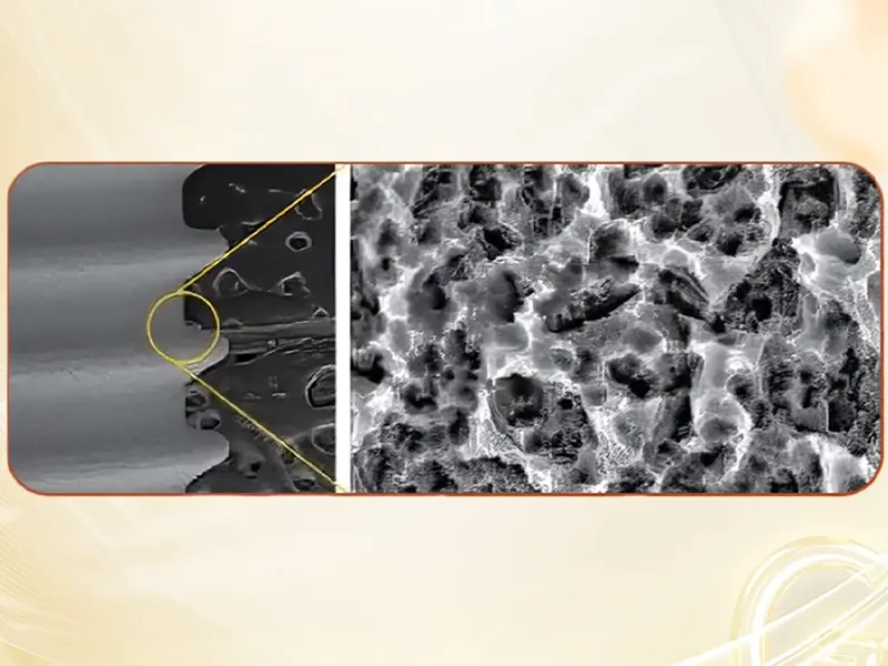 Implant Super Line Mỹ: Nền Tảng Vững Chắc Từ Cấu Tạo Và Công Nghệ 1