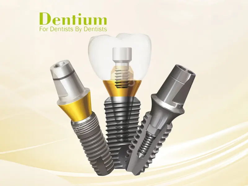 Implant Super Line Mỹ: Nền Tảng Vững Chắc Từ Cấu Tạo Và Công Nghệ 2